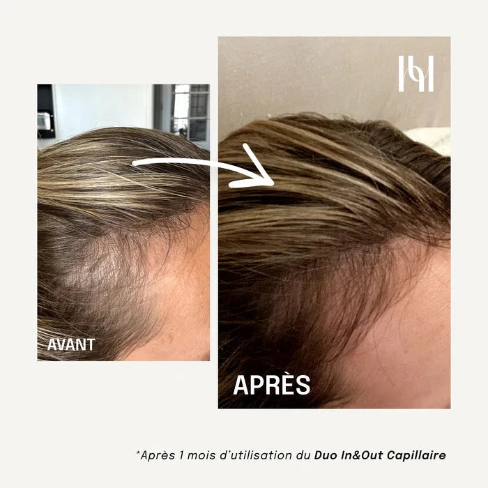 Complément Alimentaire Liquide - Capillaire Complément Alimentaire HOLITE 