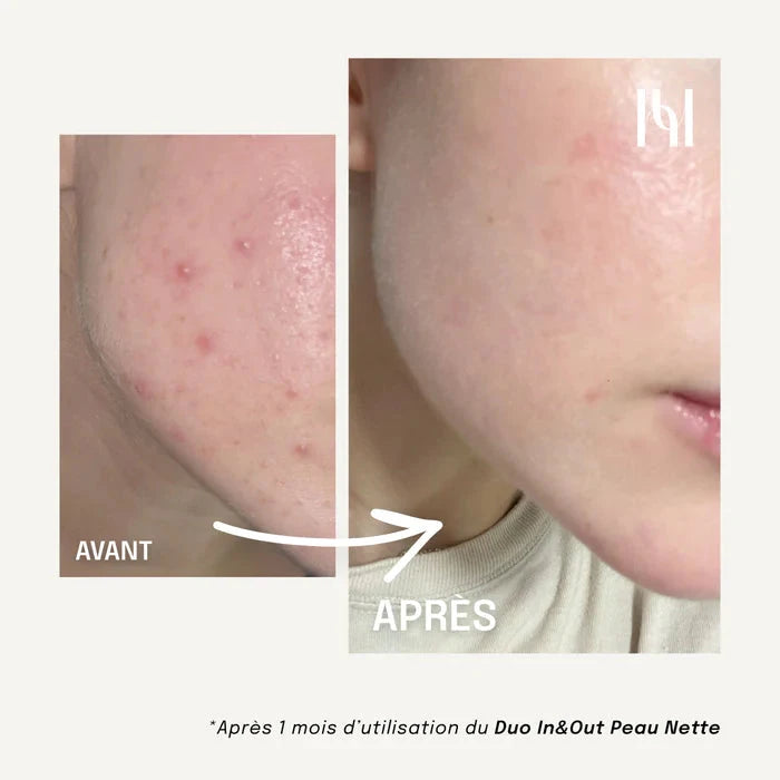 Complément Alimentaire Liquide - Visage Peau nette Complément Alimentaire HOLITE 