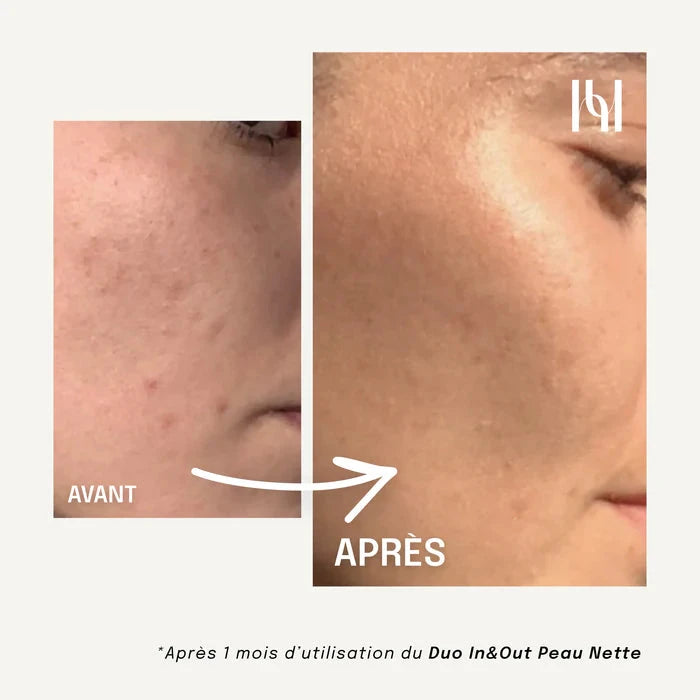 Complément Alimentaire Liquide - Visage Peau nette Complément Alimentaire HOLITE 