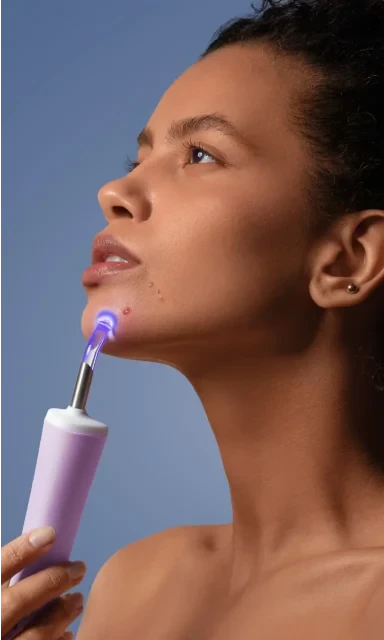 ESPADA 2 Plus Appareil Anti-acné FOREO 