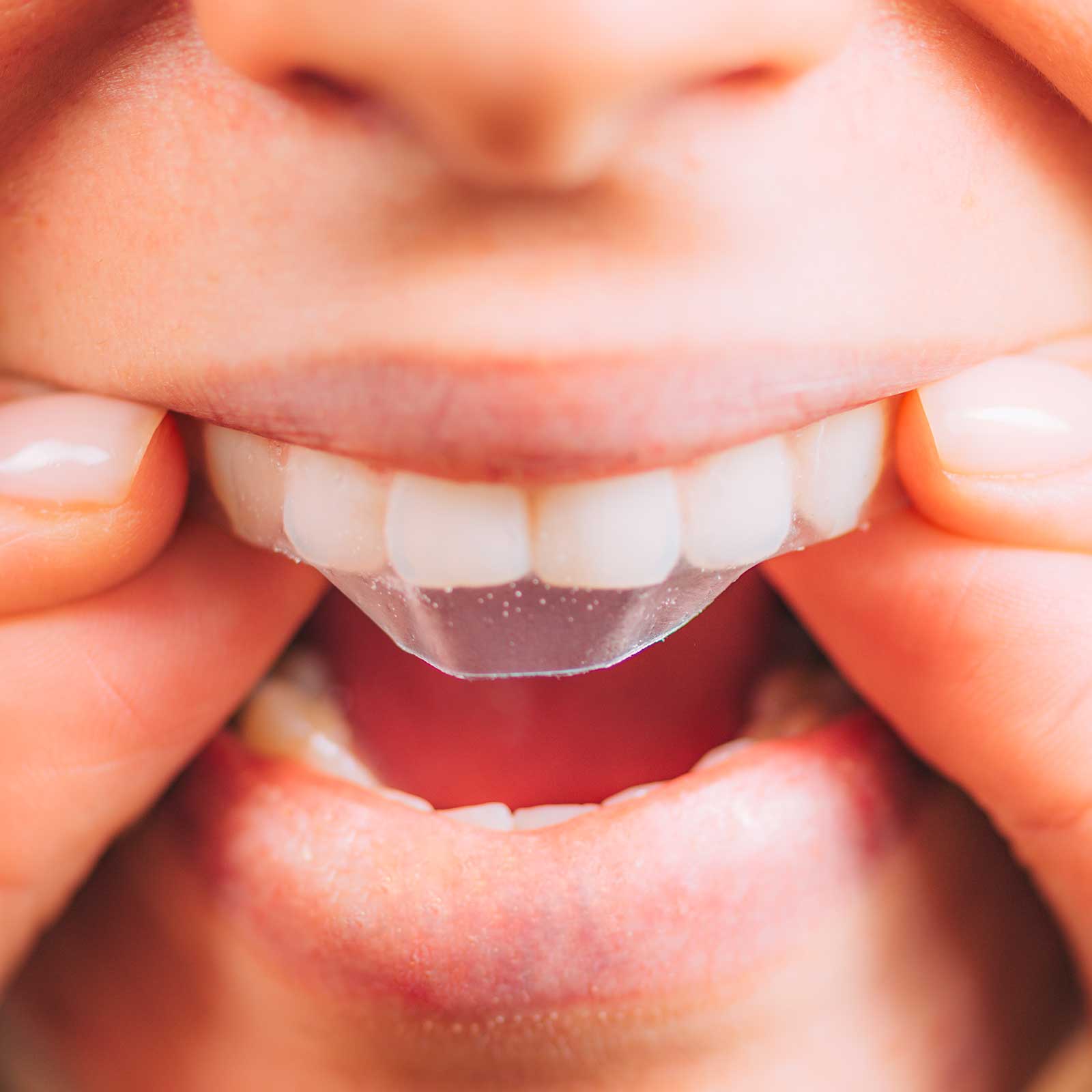 STRIPS BLANCHISSANT FRAMBOISE Soin dentaire Bbryance 