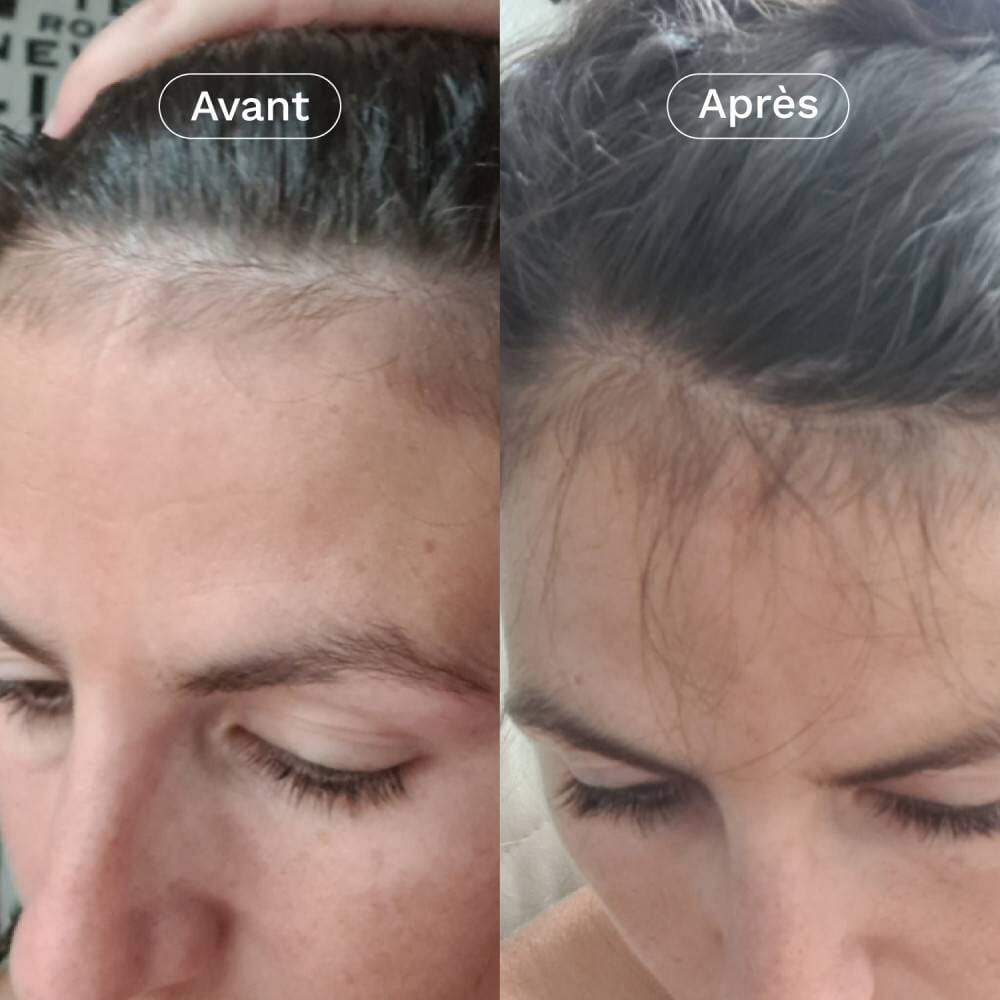 Mon Coup de Pousse - Nutricosmétique Soin Capillaire OMUM 