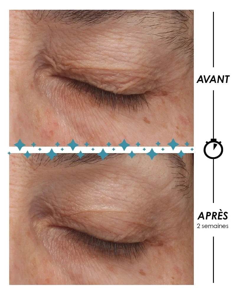 ÉTOILE Polaire - Le contour des yeux Soin Anti-Âge GARANCIA 