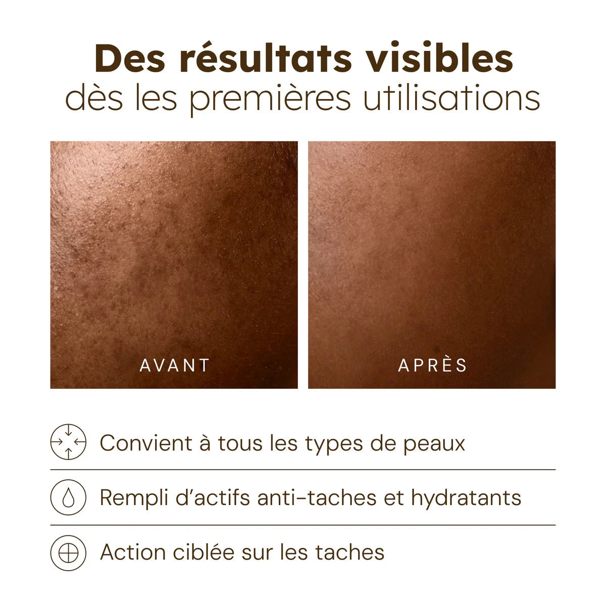 Sérum Anti-Imperfections Soin Visage Séfia 
