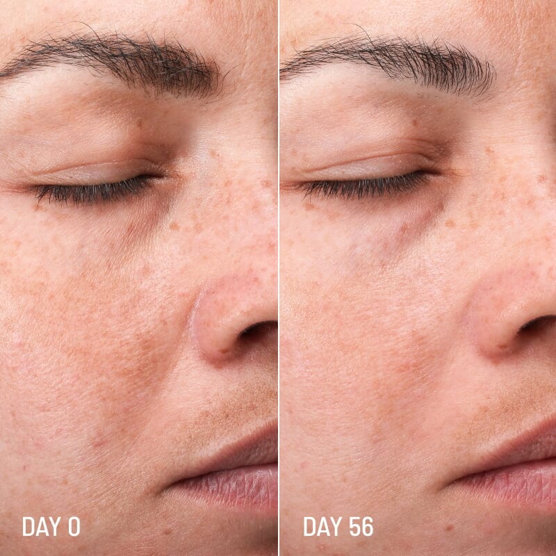 Lotus Radiance Dark Spot Treatment - Réduit l’hyperpigmentation et les taches de la peau soin de jour FRESHLY 