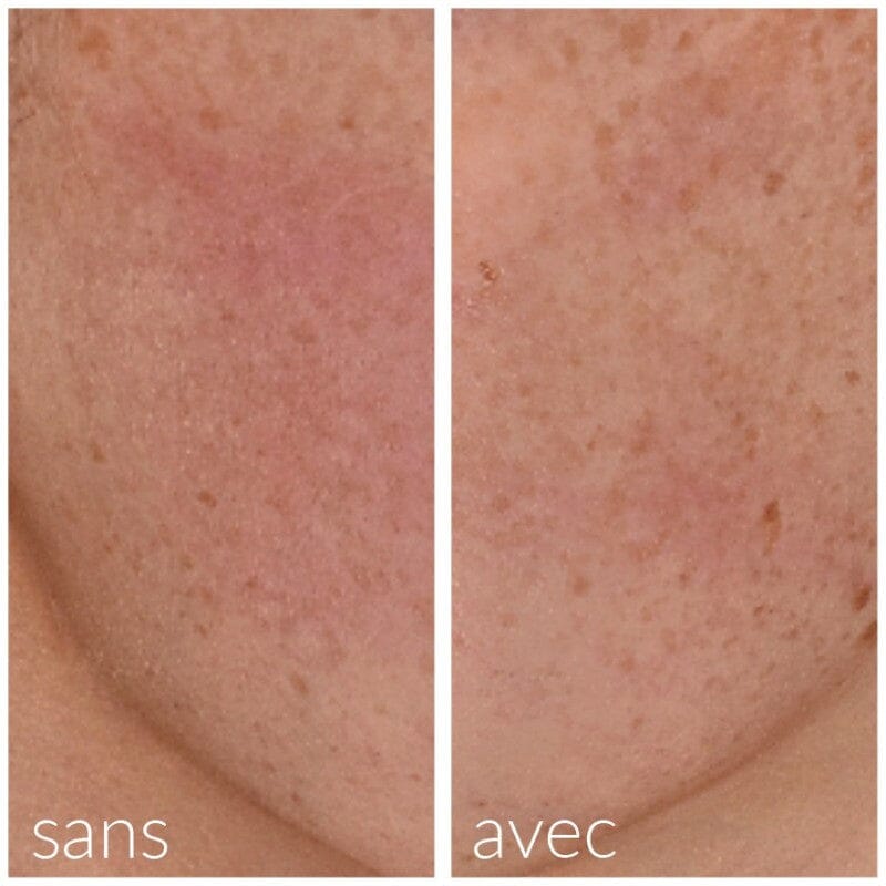 Sérum calmant et hydratant post-roller Soin Visage Meso'me 