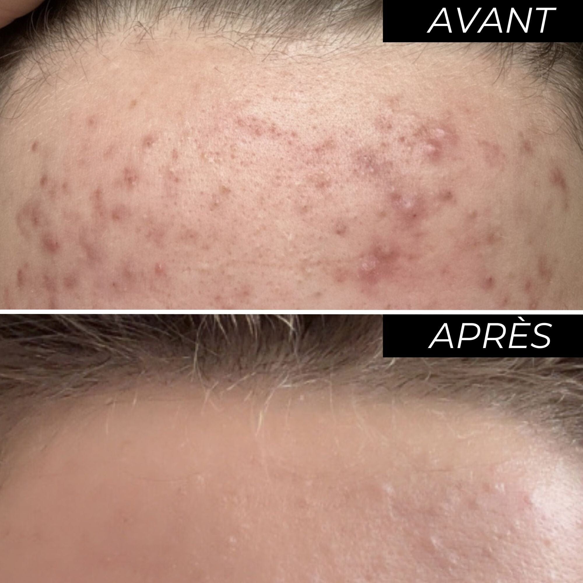 Peeling visage ENOLISS 15 Soin Visage Enotime 