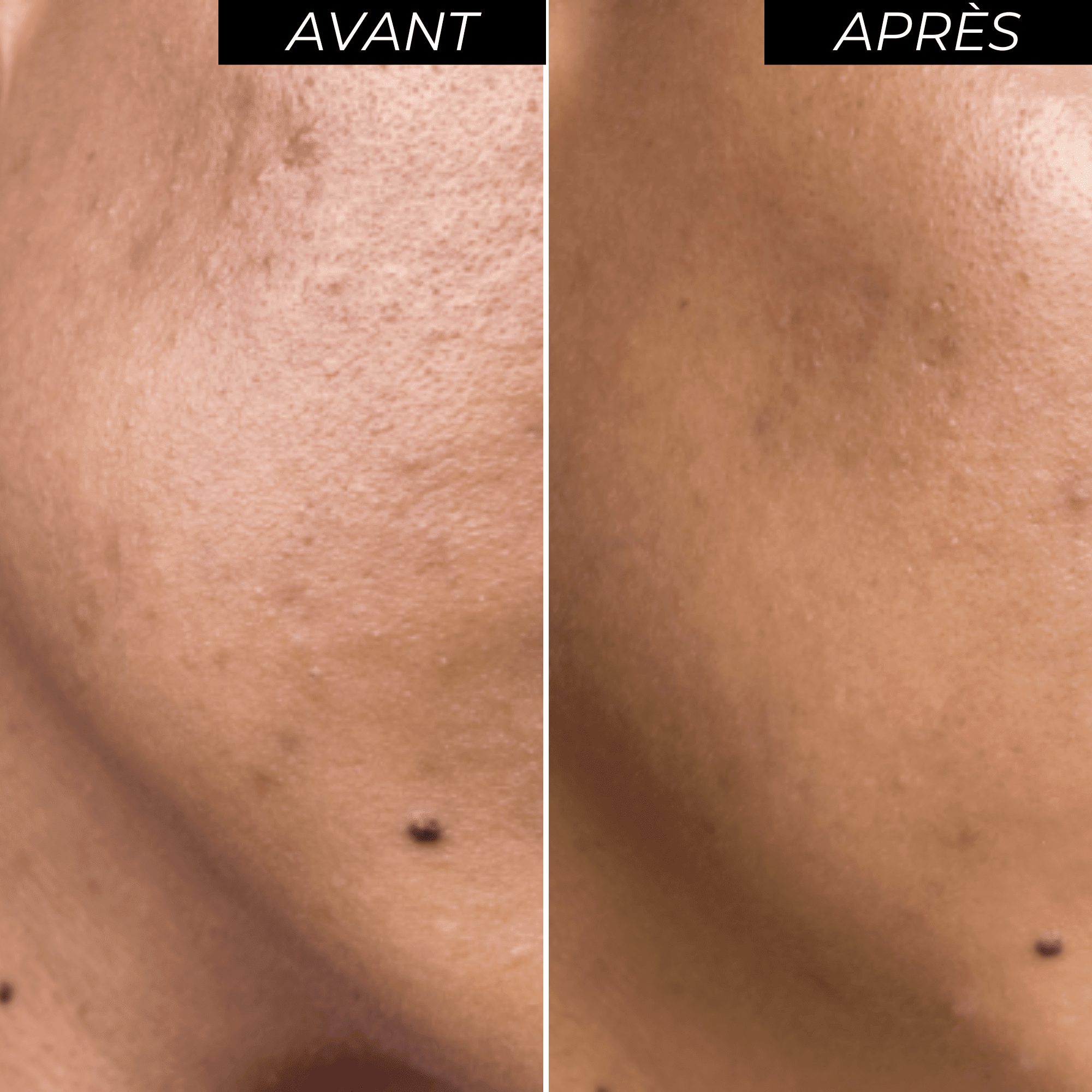 Peeling visage ENOLISS 15 Soin Visage Enotime 